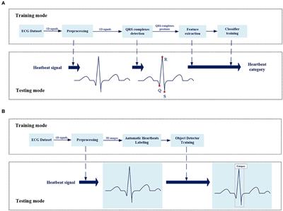 Beat-Level Interpretation of Intra-Patient Paradigm Based on Object Detection